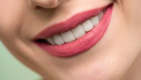 ¿Cómo conseguir una sonrisa deslumbrante y unos dientes súper blancos?